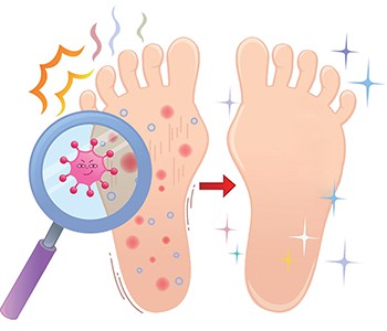 Може ли се спортистов стопало заиста проширити на руке?